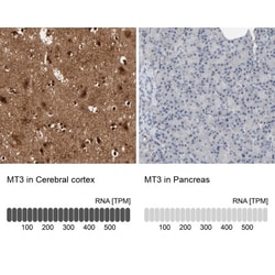 Metallothionein-3 Antibody, Novus Biologicals:Antibodies:Primary Antibodies